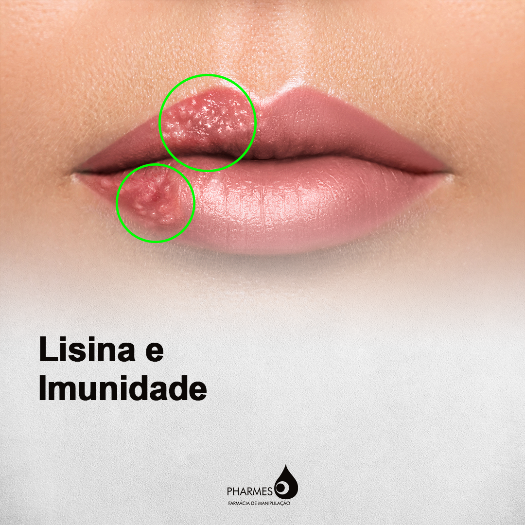 Lisina e a imunidade